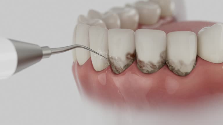 Reliable Teeth Whitening contractor in Enderlin, ND by Smile Center Dentistry